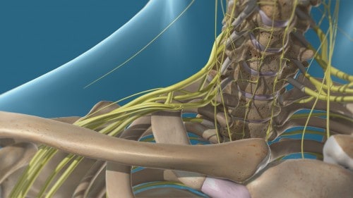 brachial plexus render | Orlando Orthopaedic Center