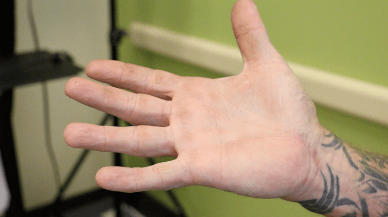 HAND-SURGERY | Orlando Orthopaedic Center